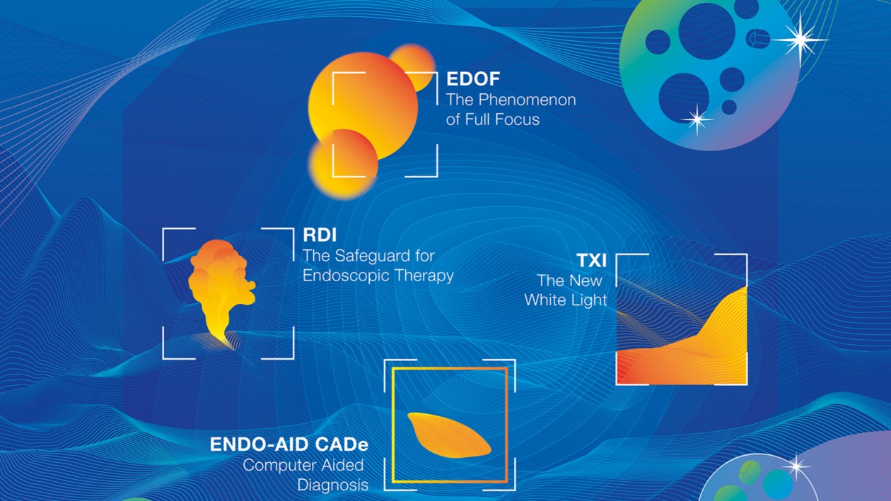 Veel nieuwe technologieën in het nieuwe endoscopieplatform EVIS X1 van Olympus: smullen voor technicus en endoscopist